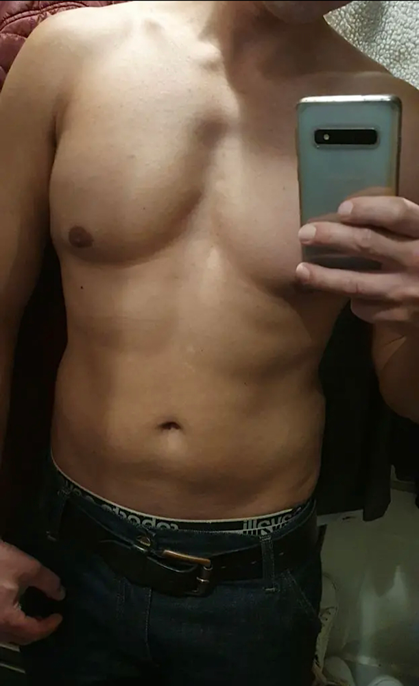 Moi